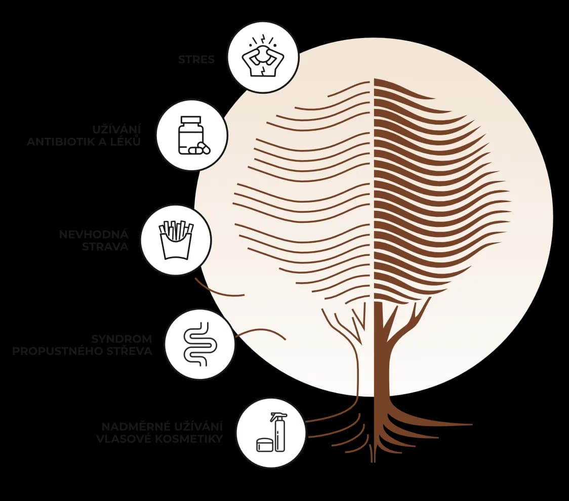 Strom — vlasový mikrobiom