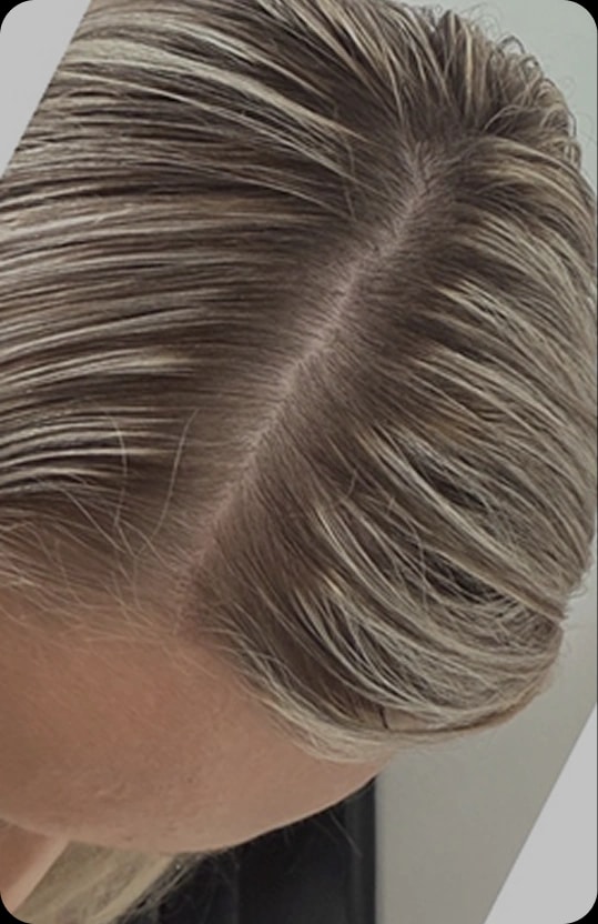 Pěšinka po třech měsících užívání Hair ProBio