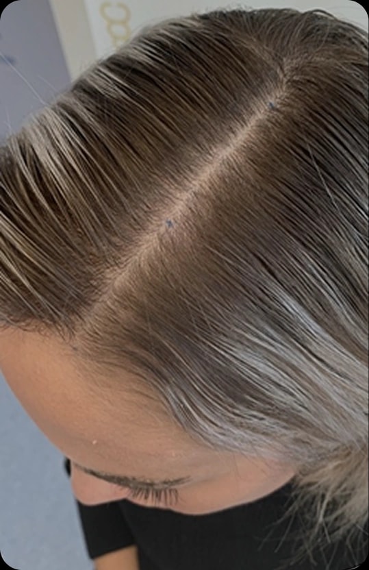 Pěšinka po měsíci užívání Hair ProBio
