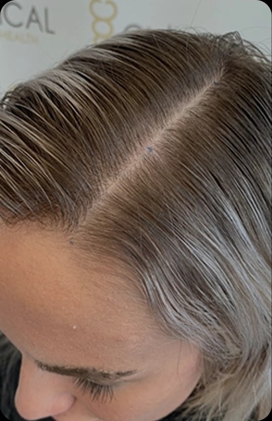 Pěšinka před užíváním Hair ProBio