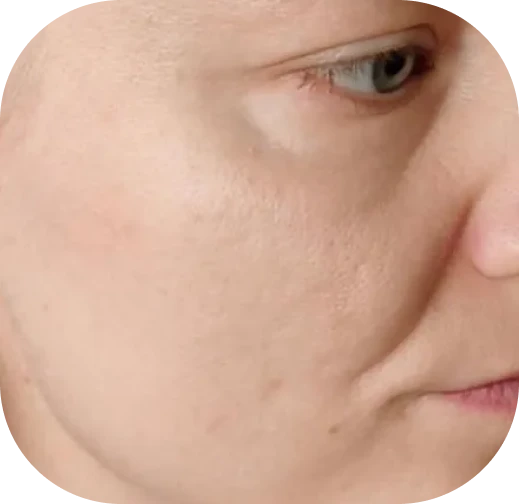 Po
