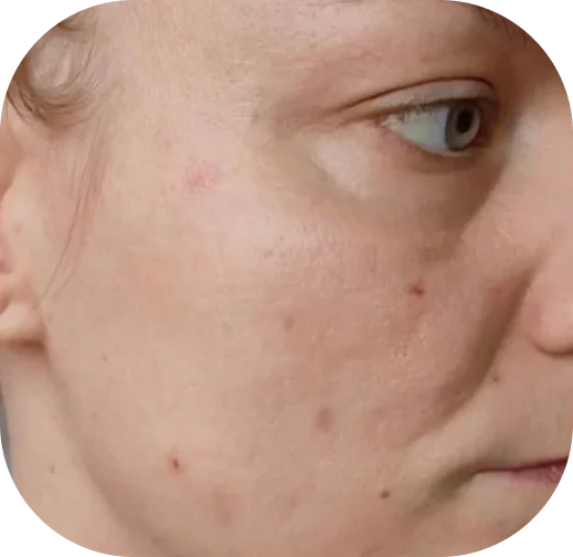 Před